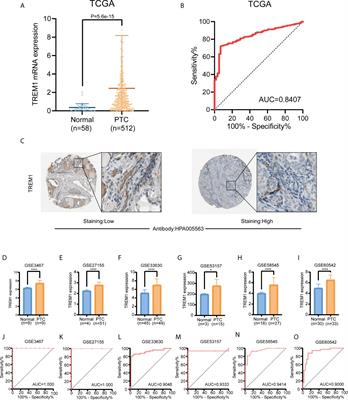 Analysis of the Prognostic Value and Potential Molecular Mechanisms of TREM-1 Overexpression in Papillary Thyroid Cancer via Bioinformatics Methods